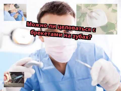 Можно ли целоваться с брекетами? Канал Dento Video