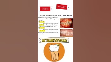 class 2 Malocclusion division i ans ii #dentistry #dentistryworld #malocclusion #dentalproblem