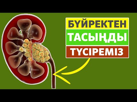 Бейне: Бүйректегі тастар диареяны тудыруы мүмкін бе?