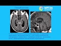 Фрайтер МР-визуализация патологий эндокринной системы