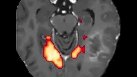 Real-time resting-state functional connectivity