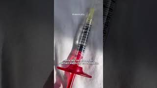 Inside the Teoxane Portal | Skin Vitality Medical Clinic BTS 🧪✨