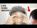 How To Naturally Cure Hair-loss , a Receding hairline , and Thinning in 30 days