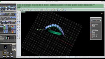Matrix 9 - Anello Parametrico