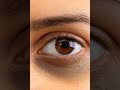 Real Reasons Of Dark Circle !! #shadowpharmacist #darkcircles ##irondeficiency #pharmacy