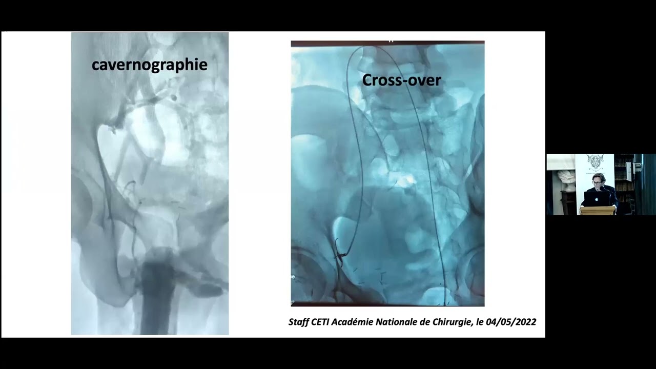 Eric Allaire Arguments Cliniques - 02