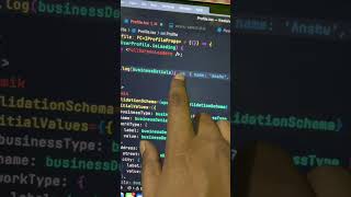 🔥 Console log Trick | Part 2 | Shorts | Viral
