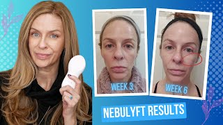 Skin Tightening Results - What I Learned Using Nebulyft R2 (3X Per Week vs. Daily Use)