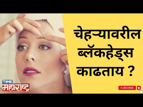 Beauty Tips, तुम्ही चेहऱ्यावरील Blackheads काढताय ?, Avoid these mistakes while removing blackheads