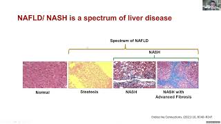 LWLD Session #3: Coping with Liver Disease (NAFLD + NASH) screenshot 3
