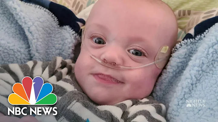 World’s Most Premature Baby Beats The Odds, Celebrates First Birthday