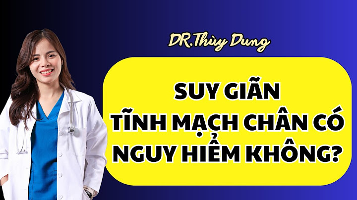 Đánh giá thuốc điều trị trĩ suy tĩnh mạch năm 2024