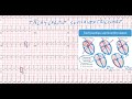 20 ecg  quiz  dr synapse