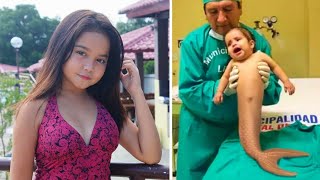 दुनिया के 5 सबसे विचित्र और अनोखे बच्चे | 5 Most Unusual Kids in the World