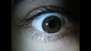 IRIS in super slow motion