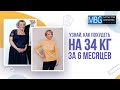 Минус 34 кг за полгода | Рукавная гастропластика, отзыв пациента