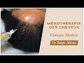 Msothrapie des cheveux  paris  clinique mdicis