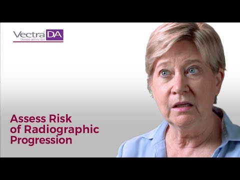 Rheumatoid Arthritis Treatment: Using Vectra DA to Assess Risk of Radiographic Progression