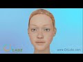 Eustachian Tube Dysfunction Animation(Aud. Tewfiq Siliman Herini… Erbil-Kurdistan tewfiqsiliman@yahoo.com... 009647504485973)