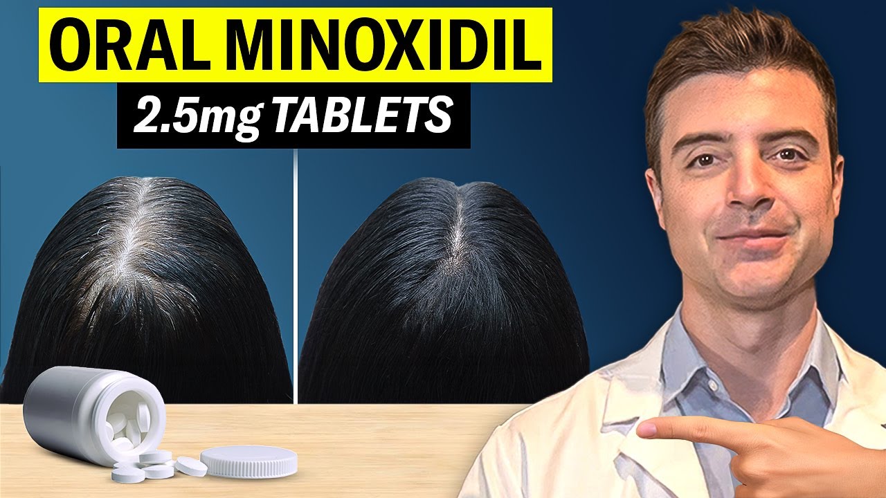 Миноксидил для приема внутрь 2,5 мг: действительно ли он помогает от выпадения волос?