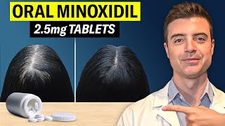 Oral Minoxidil 2.5mg: Does It Really Work for Hair Loss?