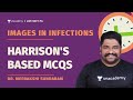 Harrison's Based MCQs with images in infections | Dr. Meenaskhi Sundaram