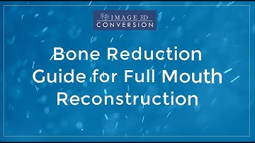 Bone Reduction Guide Process and Workflow for Dental Implant Surgery