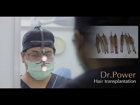 Hair transplantation (ปลูกผมถาวร) by Saroj Suvanasuthi, MD.PhD.