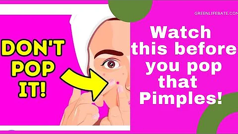 Why You Shouldn't Pop Your Pimples(What Is Actually Inside A Pimple)