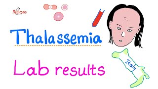 Lab results in thalassemia; How To Diagnose Thalassemia!