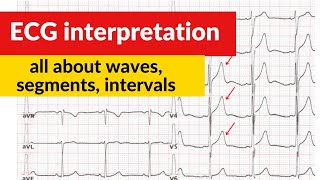 Waves. Segments. Intervals. EKG/ECG Interpretation Basics