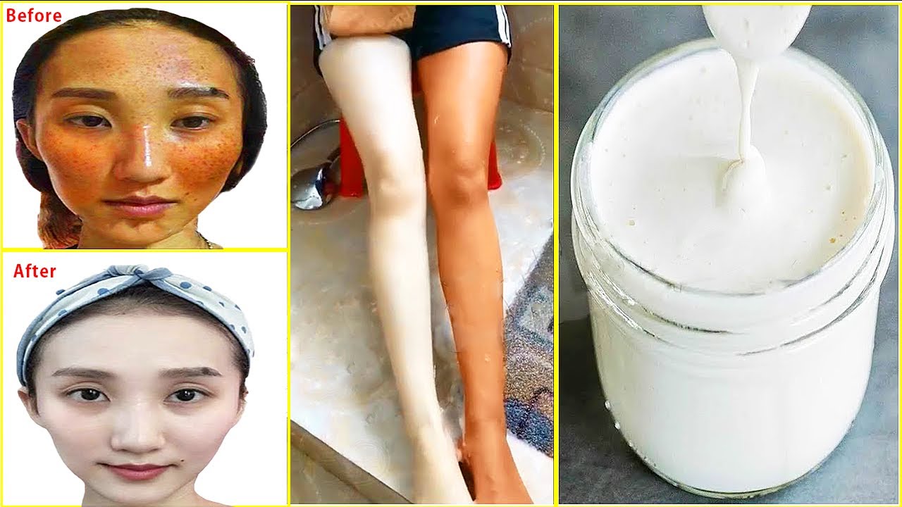 Change Your Skin Overnight ⚡ Whiten Dark Skin 100 Degrees Eliminates