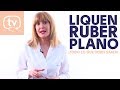 Liquen ruber plano qu es y cmo tratarlo