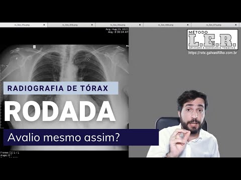 Radiografia de tórax