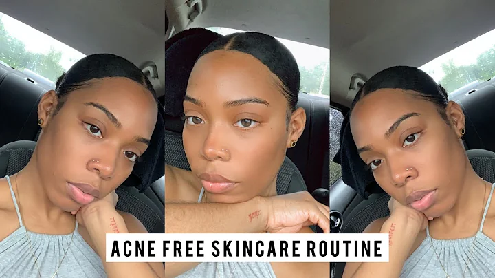 Acne Prone Skincare Routine| Fe'leecia C.