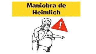 Asfixia y maniobra de Heimlich Asfixia y maniobra de Heimlich