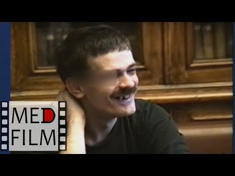 (R) Олигофрении. Задержка псих. развития © Oligophrenia, imbecility