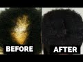 Add THIS SECRET to your Black soap shampoo to stop EXTREME Hair shedding and Hair fall instantly*!