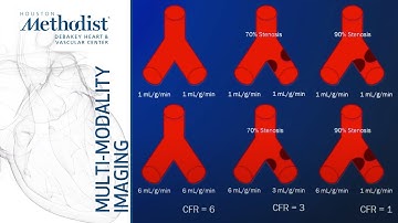 Stress CMR: Methodology,  Current Role, and Case Studies (Eric Y. Yang, MD) December 8, 2020