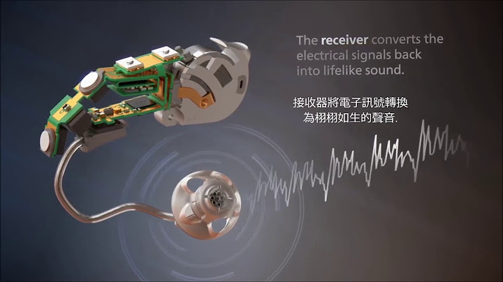 Signia德国西嘉助听器深层解析| Signia Hearing Aids - 天天要闻