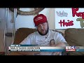 UNHINGED Democrat Attacks, Hospitalizes Man For Wearing MAGA Hat