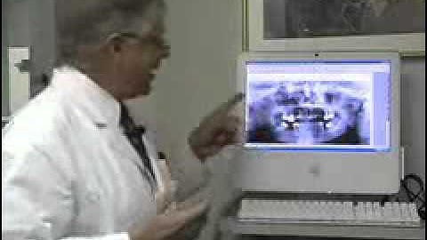 Owandy I-Max Easy Panoramic