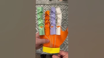 Struggling with a bent finger that snaps? Learn about trigger finger causes & risks