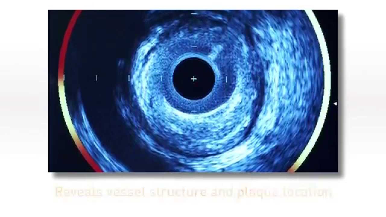 Introducing the Advanced TVC Imaging System