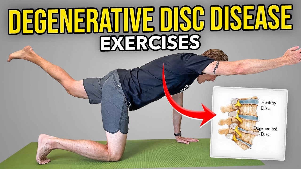 Degenerative Disc Disease Exercises Lumbar Spine YouTube Degenerative Disc Disease Exercises Lumbar Spine YouTube