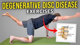 Degenerative Disc Disease Exercises (Lumbar Spine)