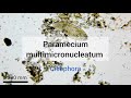 Paramecium multimicronucleatum (Ciliophora)