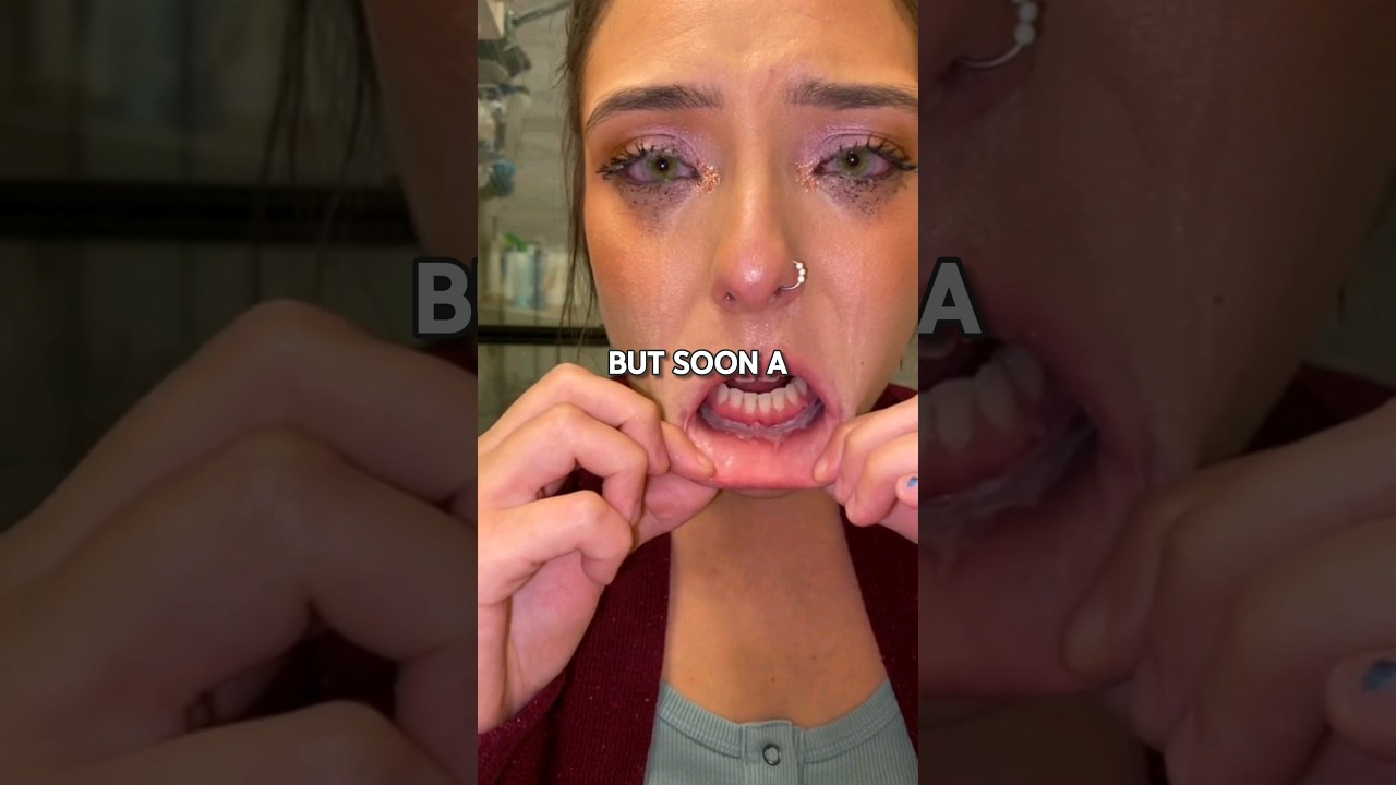 Struggling with canker sores from retainer? 