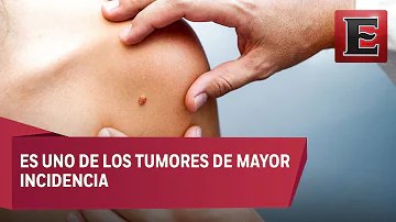 ¿Qué se siente al principio de un cáncer de piel?