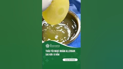 Bác sĩ tháo túi ngực nhám sau hơn 10 năm  #lamdep #thaotuinguc